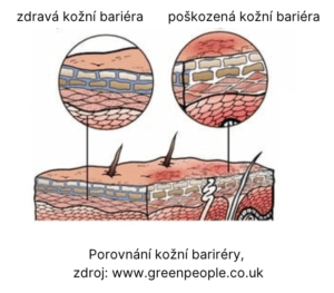 Porušená kožní bariéra