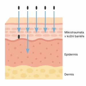 Jak fungují spikule